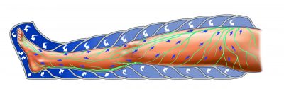 pressoterapia